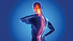 Spondylitis Treatment Services