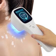 Excimer Laser Treatment for Psoriasis & Vitiligo